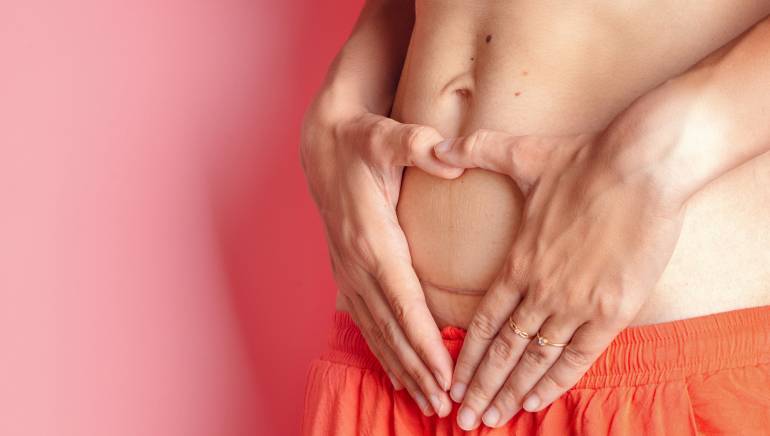 Aqui está o que a fixação da barriga pode fazer para o seu corpo pós-parto